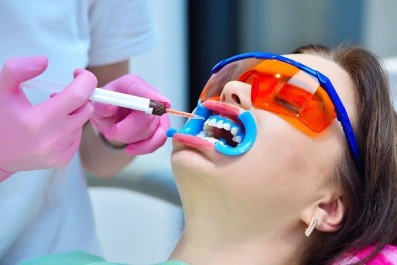 Get a brighter smile in minutes with instant results whitening Grimsby