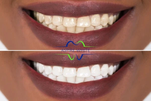 Side-by-side comparison showing before and after results of a cosmetic treatment Grimsby