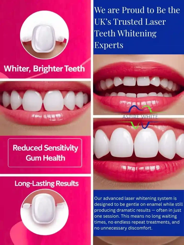 We are Proud to Be the UK’s Trusted Laser Teeth Whitening Experts Grimsby