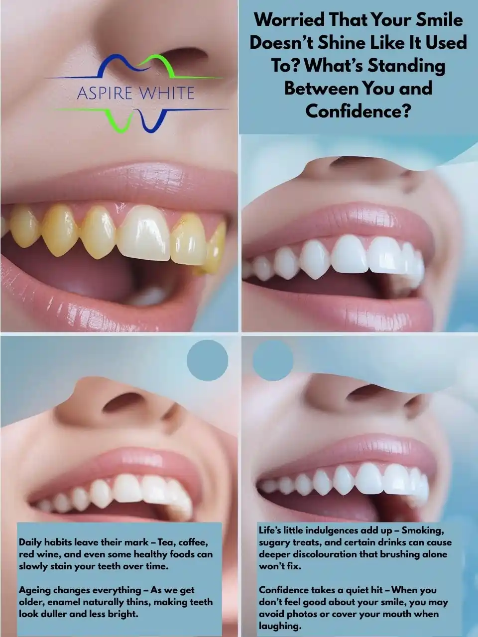 Worried That Your Smile Doesn’t Shine Like It Used To What’s Standing Between You and Confidence Grimsby